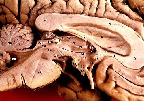 Anatomický řez lidského mozku s označením hypotalamu.
