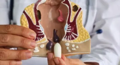 Lékař drží anatomický model konečníku pro vysvětlení příznaků.
